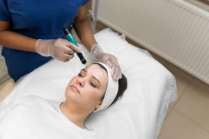 Vivace Laser Treatments